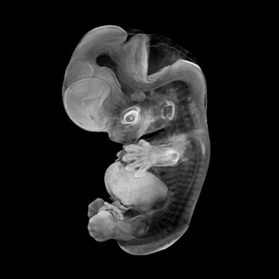 CS20 3-D model — HDBR Atlas