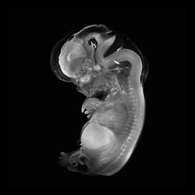 CS21 3-D model — HDBR Atlas