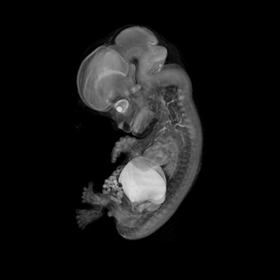 CS23 3-D model — HDBR Atlas