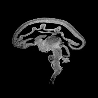 PCW 13 3-D model — HDBR Atlas
