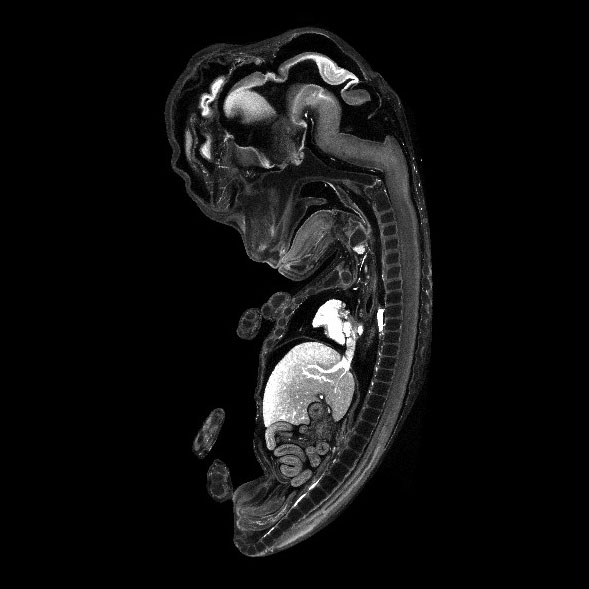 PCW 9 3-D model — HDBR Atlas